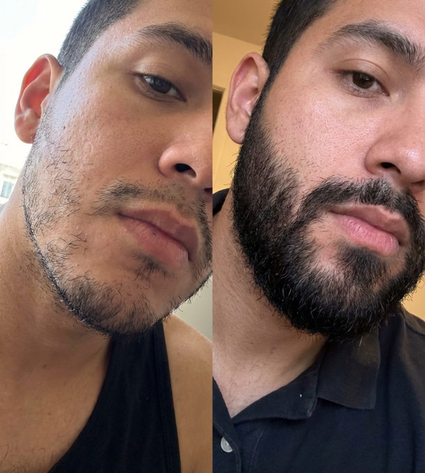 Antes y después 1
