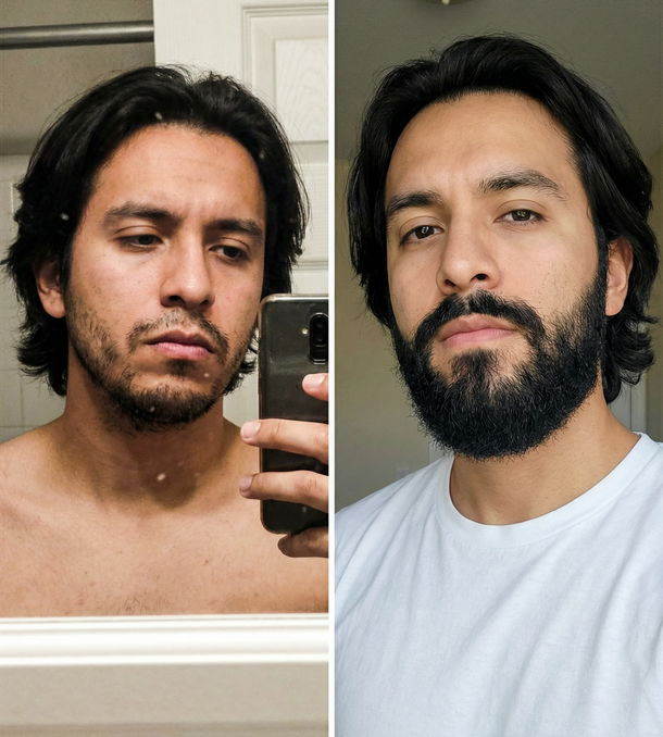 Antes y después 2